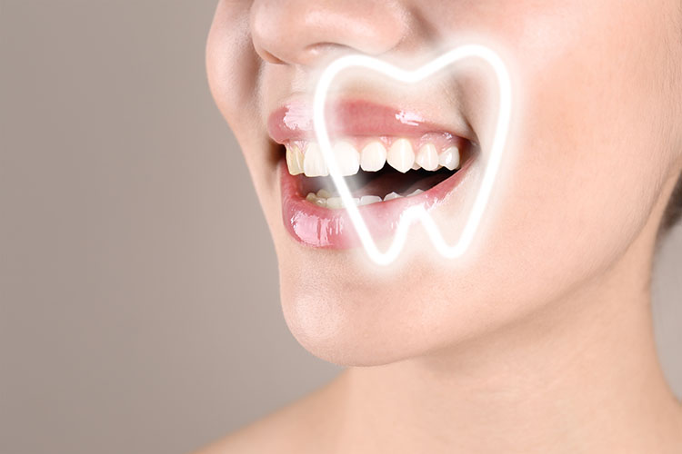 carnegie-teeth-whitening